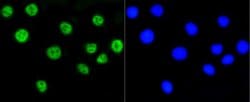 Invitrogen H2AK9ac Recombinant Rabbit Monoclonal Antibody (SR4-15) 100