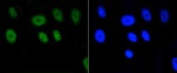 Invitrogen H2AK9ac Recombinant Rabbit Monoclonal Antibody (SR4-15) 100
