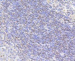 Invitrogen H2AK9ac Recombinant Rabbit Monoclonal Antibody (SR4-15) 100