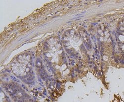 Invitrogen H2AK9ac Recombinant Rabbit Monoclonal Antibody (SR4-15) 100