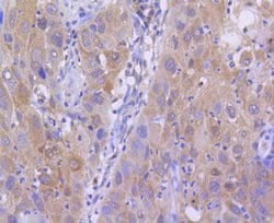Invitrogen H2AK9ac Recombinant Rabbit Monoclonal Antibody (SR4-15) 100