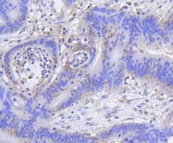 Invitrogen H2AK9ac Recombinant Rabbit Monoclonal Antibody (SR4-15) 100
