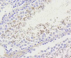 Invitrogen H2AK9ac Recombinant Rabbit Monoclonal Antibody (SR4-15) 100