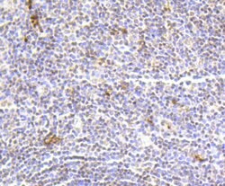 Invitrogen Hydroxyl-Histone H2A (Tyr39) Recombinant Rabbit Monoclonal Antibody
