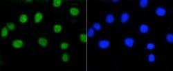 Invitrogen Phospho-Rb (Ser807) Recombinant Rabbit Monoclonal Antibody (SR3-82)