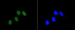 Invitrogen Phospho-Rb (Ser807) Recombinant Rabbit Monoclonal Antibody (SR3-82)