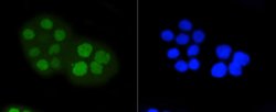 Invitrogen Phospho-Rb (Ser807) Recombinant Rabbit Monoclonal Antibody (SR3-82)