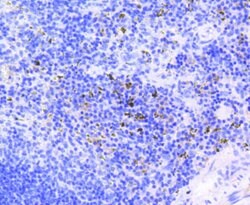 Invitrogen Phospho-Rb (Ser807) Recombinant Rabbit Monoclonal Antibody (SR3-82)