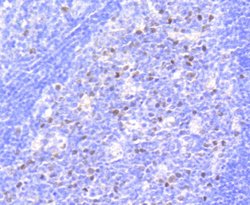 Invitrogen Phospho-Rb (Ser807) Recombinant Rabbit Monoclonal Antibody (SR3-82)