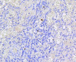 Invitrogen Phospho-Rb (Ser807) Recombinant Rabbit Monoclonal Antibody (SR3-82)