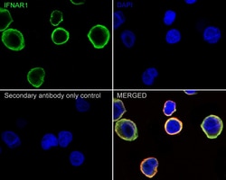 Invitrogen IFNAR1 Recombinant Rabbit Monoclonal Antibody (SR45-08) 100