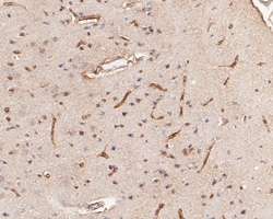 Invitrogen IFNAR1 Recombinant Rabbit Monoclonal Antibody (SR45-08) 100