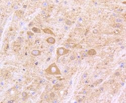 Invitrogen IFNAR1 Recombinant Rabbit Monoclonal Antibody (SR45-08) 100