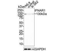 Invitrogen IFNAR1 Recombinant Rabbit Monoclonal Antibody (SR45-08) 100