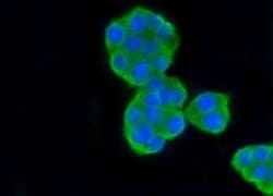 Invitrogen beta-5 Tubulin Recombinant Rabbit Monoclonal Antibody (SR25-04)