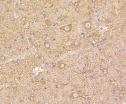 Invitrogen beta-5 Tubulin Recombinant Rabbit Monoclonal Antibody (SR25-04)