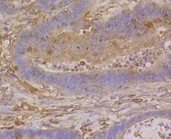Invitrogen beta-5 Tubulin Recombinant Rabbit Monoclonal Antibody (SR25-04)