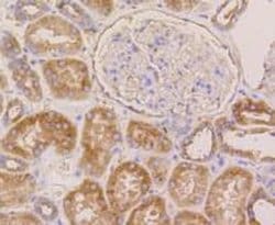 Invitrogen beta-5 Tubulin Recombinant Rabbit Monoclonal Antibody (SR25-04)