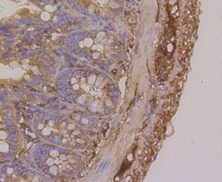 Invitrogen beta-5 Tubulin Recombinant Rabbit Monoclonal Antibody (SR25-04)