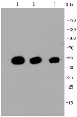 Invitrogen beta-5 Tubulin Recombinant Rabbit Monoclonal Antibody (SR25-04)