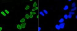 Invitrogen H4K5ac Recombinant Rabbit Monoclonal Antibody (SR31-07), ChIP-Verified:Antibodies:Primary