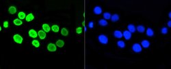 Invitrogen H4K5ac Recombinant Rabbit Monoclonal Antibody (SR31-07), ChIP-Verified:Antibodies:Primary