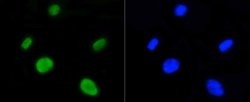 Invitrogen H4K5ac Recombinant Rabbit Monoclonal Antibody (SR31-07), ChIP-Verified:Antibodies:Primary