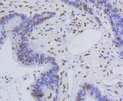 Invitrogen H4K5ac Recombinant Rabbit Monoclonal Antibody (SR31-07), ChIP-Verified:Antibodies:Primary