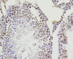 Invitrogen H4K5ac Recombinant Rabbit Monoclonal Antibody (SR31-07), ChIP-Verified:Antibodies:Primary