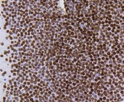 Invitrogen H4K5ac Recombinant Rabbit Monoclonal Antibody (SR31-07), ChIP-Verified:Antibodies:Primary