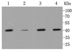 Invitrogen MMP12 Recombinant Rabbit Monoclonal Antibody (SR03-23) 100 &mu;L;