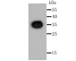 Invitrogen Renilla luciferase Recombinant Rabbit Monoclonal Antibody (SR07-830)