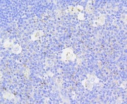 Invitrogen Active Caspase 3 Recombinant Rabbit Monoclonal Antibody (SR01-02)