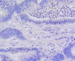 Invitrogen Active Caspase 3 Recombinant Rabbit Monoclonal Antibody (SR01-02)