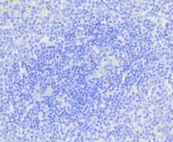 Invitrogen Active Caspase 3 Recombinant Rabbit Monoclonal Antibody (SR01-02)