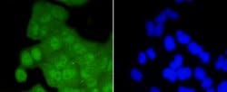 Invitrogen CDK2 Recombinant Rabbit Monoclonal Antibody (SR01-01) 100 &mu;L;