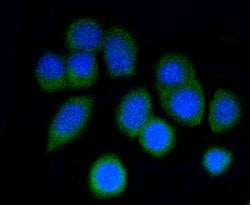 Invitrogen ARPC5 Recombinant Rabbit Monoclonal Antibody (SR34-02) 100 &mu;L;