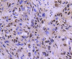 Invitrogen ATF2 Recombinant Rabbit Monoclonal Antibody (SZ17-01) 100 &mu;L | Buy Online | Invitrogen&trade; | Fisher Scientific