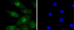 Invitrogen Phospho-ERK1/ERK2 (Thr202,Thr185) Recombinant Rabbit Monoclonal