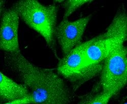 Invitrogen Phospho-ERK1/ERK2 (Thr202,Thr185) Recombinant Rabbit Monoclonal