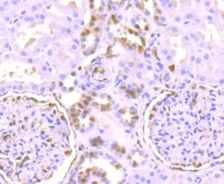 Invitrogen Phospho-ERK1/ERK2 (Thr202,Thr185) Recombinant Rabbit Monoclonal