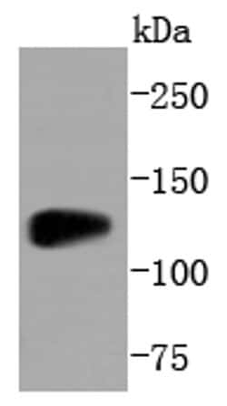 Invitrogen SIRT1 Recombinant Rabbit Monoclonal Antibody (SZ04-01) 100 &mu;L;
