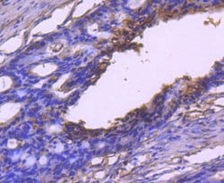 Invitrogen VEGF Recombinant Rabbit Monoclonal Antibody (SP07-01) 100 &mu;L;