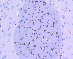 Invitrogen OLIG2 Recombinant Rabbit Monoclonal Antibody (SP07-02) 100 &mu;L | Buy Online | Invitrogen&trade; | Fisher Scientific