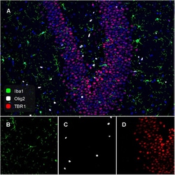 Invitrogen OLIG2 Recombinant Rabbit Monoclonal Antibody (SP07-02) 100 &mu;L | Buy Online | Invitrogen&trade; | Fisher Scientific