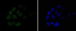 Invitrogen MSH6 Recombinant Rabbit Monoclonal Antibody (SP08-02) 100 &mu;L;