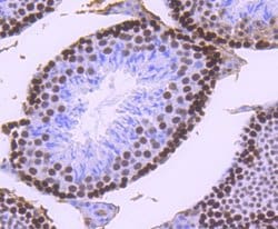 Invitrogen MSH6 Recombinant Rabbit Monoclonal Antibody (SP08-02) 100 &mu;L;