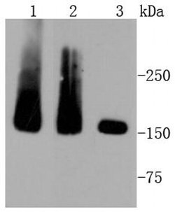 Invitrogen MSH6 Recombinant Rabbit Monoclonal Antibody (SP08-02) 100 &mu;L;