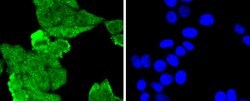 MLH1 Recombinant Rabbit Monoclonal Antibody (SP08-04):Antibodies, Recombinant