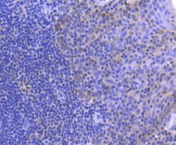 MLH1 Recombinant Rabbit Monoclonal Antibody (SP08-04):Antibodies, Recombinant
